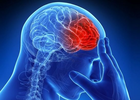 علائیم سکته مغزی چیست