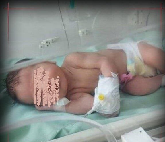 نوزاد پیدا شده در سطل آشغال نازی آباد تهران دارای عفونت ریه است